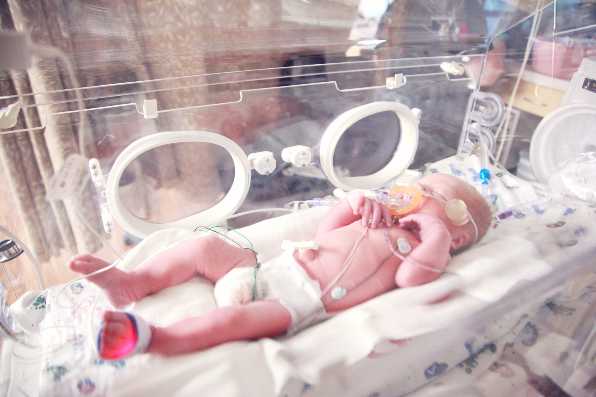 Allo Ortho La Prematurite C Est Quoi Allo Ortho La Prematurite C Est Quoi